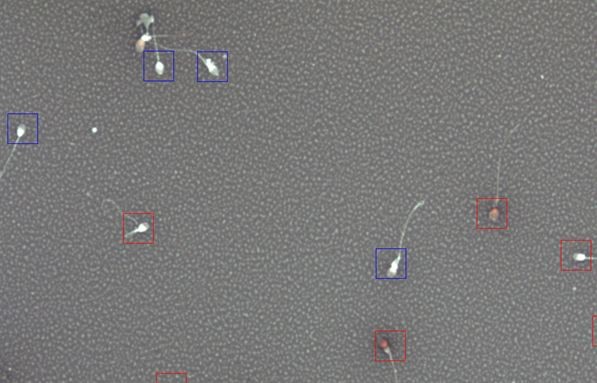 Let's not Sperm test vitality Speaking, opinion, Sperm test vitality opinion