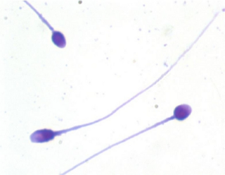 SpermBlue tinción para la evaluación de la morfología espermática