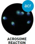 Acrosome reaction - SCA® CASA System