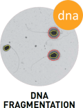 DNA Fragmentation - SCA® CASA System