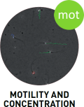 Motility and concentration - SCA® CASA System