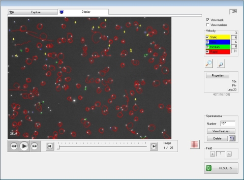 figure_of_the_motility_analysis figure_of_the_motility_analysis