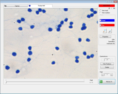 morphology_staining_with_spermblue morphology_staining_with_spermblue