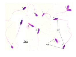 abnormal_sperm_forms abnormal_sperm_forms