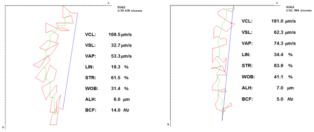 hyperactivation_of_sperm_2 hyperactivation_of_sperm_2