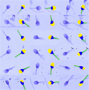 image4_abril_2016_blog Modern analysis of sperm morphometry/morphology of human sperm using Microptic SCA CASA system -accurate, consistent and good for quality control.
