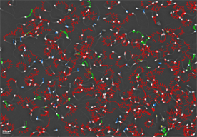 Fig. 5: Elephant sperm motility tracks of hyperactivated sperm in red – green tracks medium speed and blue slow swimming sperm