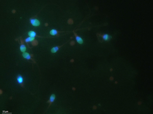 Acrosome intact sperm with green acrosomes. Acrosome reacted are only blue.