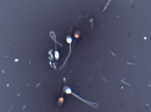 In this example all white sperm show osmotic swelling of tails –usually folded back in a loop as it contains a swelling droplet at that point. In contrast the pink sperm have thin straight tails – burst. So here HOS = Percent vitality