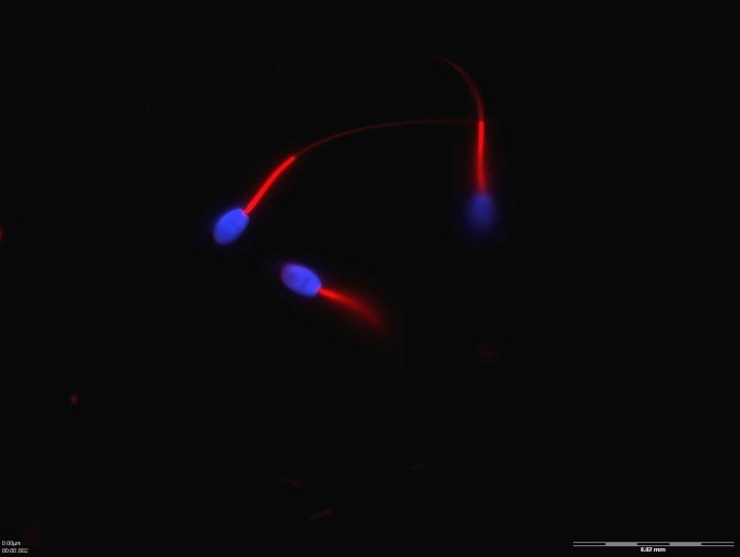 Sperm of Rhesus monkeys