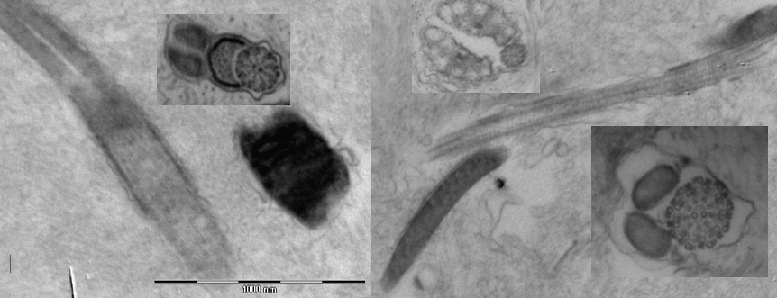 Fig. 2: Different images of sperm head, sperm flagellar axonemes, mitochondria and mitochondrial derivatives as viewed by transmission electron microscopy. 