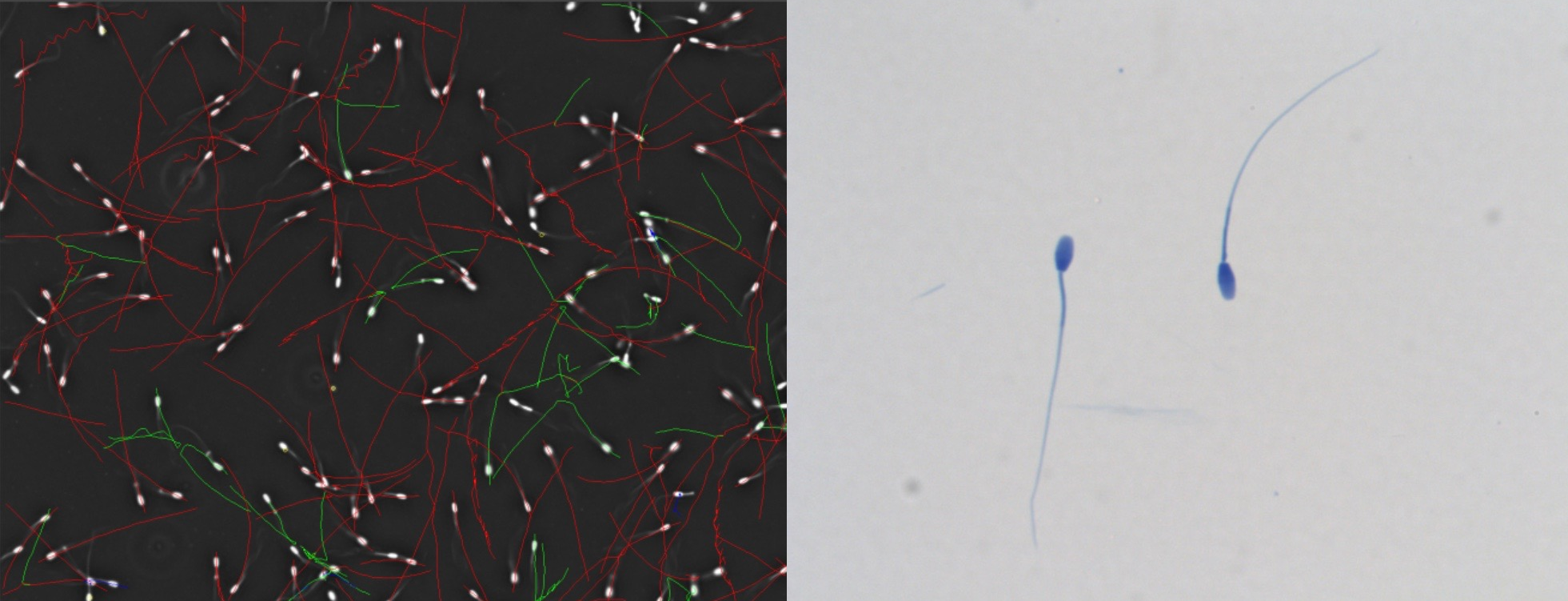 Sperm motility - sperm stained