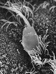 Scanning electron micrograph of rabbit sperm in oviduct.