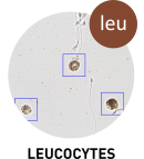 Leucocytes - Système CASA SCA®