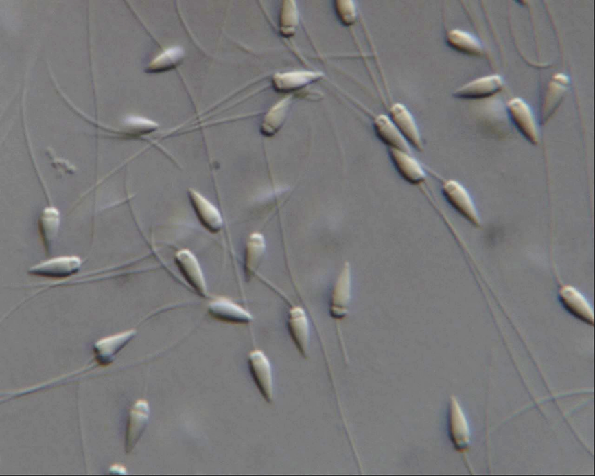 sea-urchin sperm