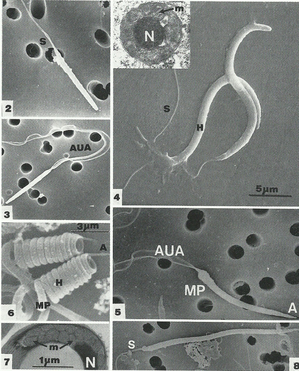 Scanning electron microscopy of sperm of some South African frog species