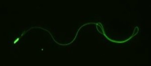 Fluorescence microscopy of African bee sperm 