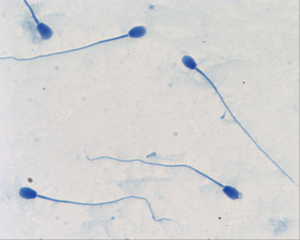 Semen sample of dog (Domestic animals sperm)