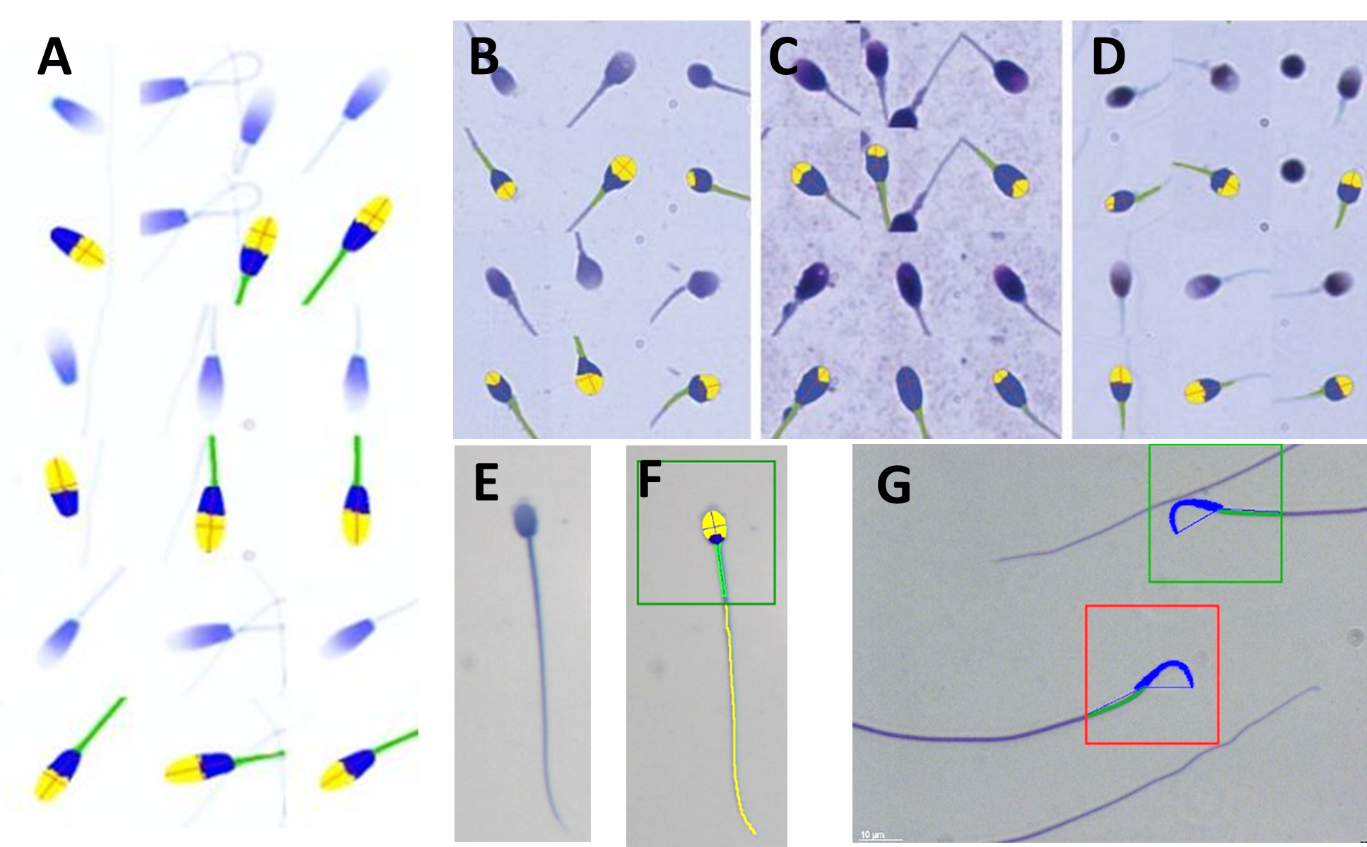 sperm of different species stained 