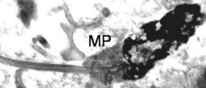 Transmission electron micrograph of naked mole rat sperm..